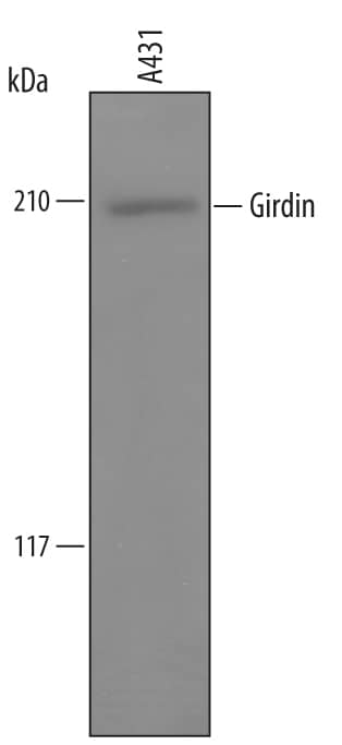 Western blot shows lysates of A431 human epithelial carcinoma cell line. PVDF membrane was probed with 1 µg/mL of Sheep Anti-Human Girdin Biotinylated Antigen Affinity-purified Polyclonal Antibody (Catalog # BAF5345) followed by HRP-conjugated Anti-Sheep IgG Secondary Antibody (Catalog # HAF016). A specific band was detected for Girdin at approximately 210 kDa (as indicated). This experiment was conducted under reducing conditions and using Immunoblot Buffer Group 1.