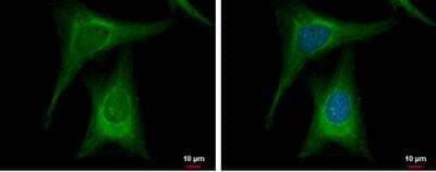Immunocytochemistry/Immunofluorescence: Glucokinase/GCK Antibody [NBP1-33144] -  HeLa cells were fixed in 4% paraformaldehyde at RT for 15 min. Green: Glucokinase protein stained by Glucokinase antibody [N1C1-2] diluted at 1:500.Blue: Hoechst 33342 staining.