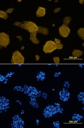 Glut2 was detected in immersion fixed  beta TC-6 mouse beta cell insulinoma cell line using Rat Anti-Mouse Glut2 Biotinylated Monoclonal Antibody (Catalog # BAM1440) at 10 µg/mL for 3 hours at room temperature. Cells were stained using the NorthernLights™ 557-conjugated Anti-Rat IgG Secondary Antibody (yellow, upper panel; Catalog # NL013) and counterstained with DAPI (blue, lower panel). View our protocol for Fluorescent ICC Staining of Cells on Coverslips.