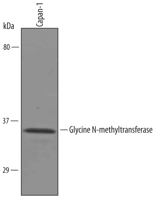 Western Blot Glycine N-Methyltransferase/GNMT Antibody