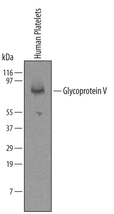 Western blot shows lysates of human platelets. PVDF membrane was probed with 2 µg/mL of Mouse Anti-Human Glycoprotein V/ CD42d Monoclonal Antibody (Catalog # MAB42491) followed by HRP-conjugated Anti-Mouse IgG Secondary Antibody (Catalog # HAF007). A specific band was detected for Glycoprotein V/CD42d at approximately 83 kDa (as indicated). This experiment was conducted under reducing conditions and using Immunoblot Buffer Group 1.