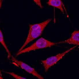 Glypican 1 was detected in immersion fixed MDA-MB-231 human breast cancer cell line using Goat Anti-Human Glypican 1 Antigen Affinity-purified Polyclonal Antibody (Catalog # AF4519) at 10 µg/mL for 3 hours at room temperature. Cells were stained using the NorthernLights™ 557-conjugated Anti-Goat IgG Secondary Antibody (red; Catalog # NL001) and counterstained with DAPI(blue). Specific staining was localized to cytoplasmic. View our protocol for Fluorescent ICC Staining of Cells on Coverslips.