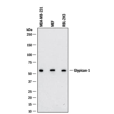 Western blot shows lysates of MDA-MB-231 human breast cancer cell line, MEF mouse embryonic feeder cells, and RBL-1 rat basophilic leukemia cell line. PVDF membrane was probed with 2 µg/mL of Mouse Anti-Human/Mouse/Rat Glypican 1 Monoclonal Antibody (Catalog # MAB45191) followed by HRP-conjugated Anti-Mouse IgG Secondary Antibody (Catalog # HAF018). A specific band was detected for Glypican 1 at approximately 62 kDa (as indicated). This experiment was conducted under reducing conditions and using Immunoblot Buffer Group 1.