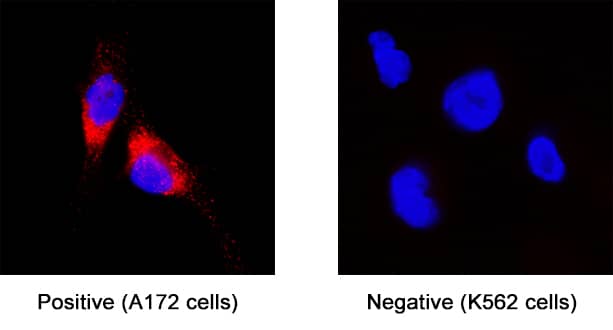 Glypican 1 was detected in immersion fixed A172 human glioblastoma cell line (positive) and not K562 human chronic myelogenous leukemia cell line (negative control) using Mouse Anti-Human Glypican 1 Monoclonal Antibody (Catalog # MAB4519) at 8 µg/mL for 3 hours at room temperature. Cells were stained using the NorthernLights™ 557-conjugated Anti-Mouse IgG Secondary Antibody (red; Catalog # NL007) and counterstained with DAPI (blue). Specific staining was localized to cytoplasm. View our protocol for Fluorescent ICC Staining of Cells on Coverslips.