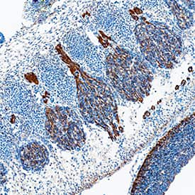 Glypican 2 was detected in perfusion fixed frozen sections of mouse embryo (11 d.p.c.) using Goat Anti-Mouse Glypican 2 Antigen Affinity-purified Polyclonal Antibody (Catalog # AF2355) at 0.3 µg/mL overnight at 4 °C. Tissue was stained using the Anti-Goat HRP-DAB Cell & Tissue Staining Kit (brown; Catalog # CTS008) and counterstained with hematoxylin (blue). Specific staining was localized to dorsal root ganglia. View our protocol for Chromogenic IHC Staining of Frozen Tissue Sections.