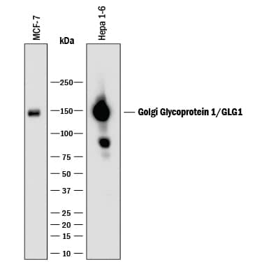Western blot shows lysates of MCF-7 human breast cancer cell line and Hepa 1-6 mouse hepatoma cell line. PVDF membrane was probed with 2 µg/mL of Mouse Anti-Human/Mouse Golgi Glycoprotein 1/GLG1 Monoclonal Antibody (Catalog # MAB78791) followed by HRP-conjugated Anti-Mouse IgG Secondary Antibody (Catalog # HAF018). A specific band was detected for Golgi Glycoprotein 1/GLG1 at approximately 150 kDa (as indicated). This experiment was conducted under reducing conditions and using Immunoblot Buffer Group 1.