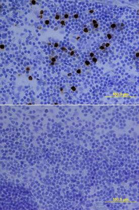 Ly-6G/Ly-6C (Gr-1) was detected in immersion fixed frozen sections of mouse spleen using Rat Anti-Mouse Ly-6G/Ly-6C (Gr-1) Biotinylated Monoclonal Antibody (Catalog # BAM1037) at 15 µg/mL overnight at 4 °C. Tissue was stained using the Anti-Rat HRP-DAB Cell & Tissue Staining Kit (brown; Catalog # CTS017) and counterstained with hematoxylin (blue). Lower panel shows a lack of labeling if primary antibodies are omitted and tissue is stained only with secondary antibody followed by incubation with detection reagents. View our protocol for Chromogenic IHC Staining of Frozen Tissue Sections.