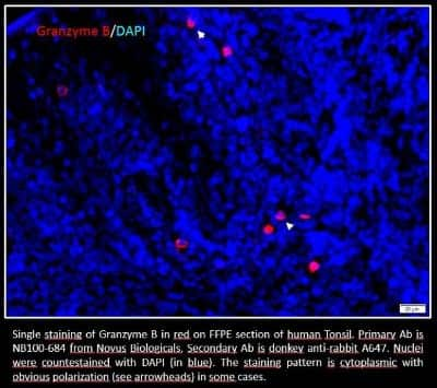 Granzyme B Antibody (NB100-684): Novus Biologicals