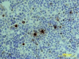 Granzyme B was detected in immersion fixed frozen sections of mouse spleen using Goat Anti-Mouse Granzyme B Biotinylated Antigen Affinity-purified Poly-clonal Antibody (Catalog # BAF1865) at 15 µg/mL overnight at 4 °C. Tissue was stained using the Anti-Goat HRP-DAB Cell & Tissue Staining Kit (brown; Catalog # CTS008) and counter-stained with hematoxylin (blue). View our protocol for Chromogenic IHC Staining of Frozen Tissue Sections.