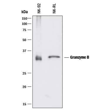 Western blot shows lysates of NK-92 human natural killer lymphoma cell line and NK-RL human natural killer lymphocytic leukemia cell line. PVDF membrane was probed with 0.5 µg/mL of Rabbit Anti-Human Granzyme B Monoclonal Antibody (Catalog # MAB29061) followed by HRP-conjugated Anti-Rabbit IgG Secondary Antibody (Catalog # HAF008). A specific band was detected for Granzyme B at approximately 34 kDa (as indicated). This experiment was conducted under reducing conditions and using Immunoblot Buffer Group 1.