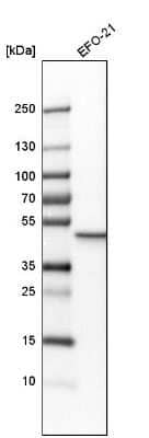 Western Blot: Guanine deaminase Antibody [NBP1-87562] - Analysis in human cell line EFO-21.