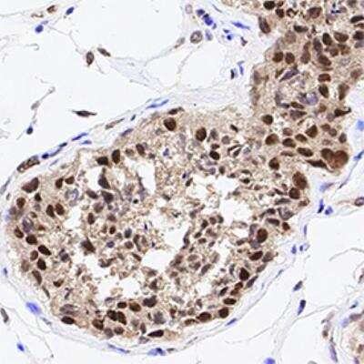 Immunohistochemistry-Paraffin HDAC1 Antibody