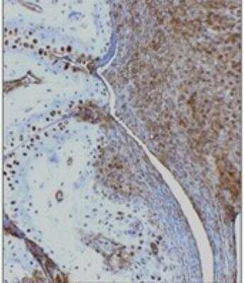 Immunohistochemistry-Paraffin: HMGB1/HMG-1 Antibody [NBP2-27117] - Analysis of decalcified, FFPE tissue sections from the paws of mice with collagen-induced arthritis using the HMGB1 antibody. The antibody was used at 5 ug/ml. Data courtesy of Dr Ulf Andersson, Karolinska Institute.