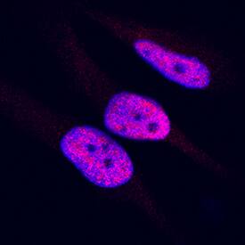 HMGB1/HMG-1 was detected in immersion fixed HeLa human cervical epithelial carcinoma cell line using Mouse Anti-Human/Mouse HMGB1/HMG-1 Monoclonal Antibody (Catalog # MAB16902) at 8 µg/mL for 3 hours at room temperature. Cells were stained using the NorthernLights™ 557-conjugated Anti-Mouse IgG Secondary Antibody (red; Catalog # NL007) and counterstained with DAPI (blue). Specific staining was localized to nuclei. View our protocol for Fluorescent ICC Staining of Cells on Coverslips.