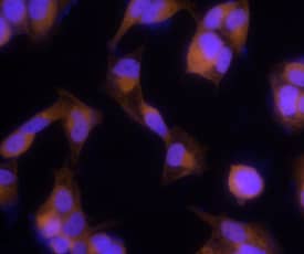 HOIP/RNF31 was detected in immersion fixed MCF-7 human breast cancer cell line using Sheep Anti-Human HOIP/RNF31 Antigen Affinity-purified Polyclonal Antibody (Catalog # AF8039) at 5 µg/mL for 3 hours at room temperature. Cells were stained using the NorthernLights™ 557-conjugated Anti-Sheep IgG Secondary Antibody (red; Catalog # NL010) and counterstained with DAPI (blue). Specific staining was localized to cytoplasm. View our protocol for Fluorescent ICC Staining of Cells on Coverslips.