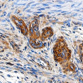 HOIP/RNF31 was detected in immersion fixed paraffin-embedded sections of human uterus using Sheep Anti-Human HOIP/RNF31 Antigen Affinity-purified Polyclonal Antibody (Catalog # AF8039) at 10 µg/mL overnight at 4 °C. Tissue was stained using the Anti-Sheep HRP-DAB Cell & Tissue Staining Kit (brown; Catalog # CTS019) and counterstained with hematoxylin (blue). Specific staining was localized to cytoplasm in epithelial cells. View our protocol for Chromogenic IHC Staining of Paraffin-embedded Tissue Sections.