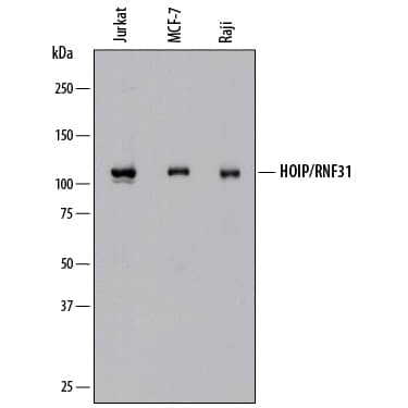 Western Blot HOIP/RNF31 Antibody