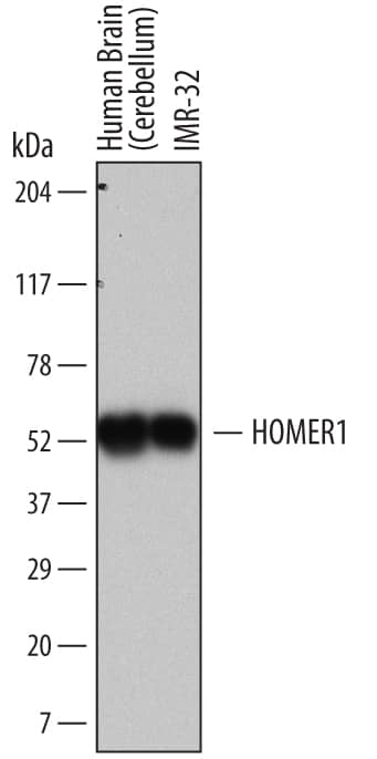 Western blot shows lysates of human brain (cerebellum) tissue and IMR-32 human neuroblastoma cell line. PVDF membrane was probed with 2 µg/mL of Mouse Anti-HOMER1 Monoclonal Antibody (Catalog # MAB6889) followed by HRP-conjugated Anti-Mouse IgG Secondary Antibody (Catalog # HAF007). A specific band was detected for HOMER1 at approximately 52 kDa (as indicated). This experiment was conducted under reducing conditions and using Immunoblot Buffer Group 5.