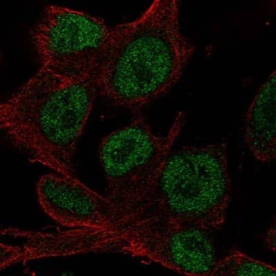 Immunocytochemistry/Immunofluorescence: HOXD4 Antibody [NBP2-49631] - Staining of human cell line SK-MEL-30 shows localization to nucleoplasm. Antibody staining is shown in green.