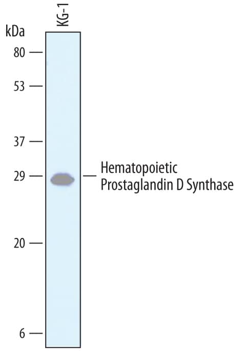 Western blot shows lysates of KG-1 human acute myelogenous leukemia cell line. PVDF membrane was probed with 1 µg/mL of Sheep Anti-Human Hematopoietic Prostaglandin D Synthase/HPGDS Antigen Affinity-purified Polyclonal Antibody (Catalog # AF6487) followed by HRP-conjugated Anti-Sheep IgG Secondary Antibody (Catalog # HAF016). A specific band was detected for Hematopoietic Prostaglandin D Synthase/HPGDS at approximately 28 kDa (as indicated). This experiment was conducted under reducing conditions and using Immunoblot Buffer Group 1.