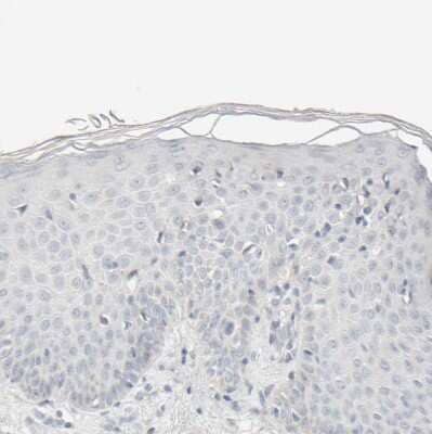Immunohistochemistry-Paraffin: HRSP12 Antibody [NBP1-82452] - Staining of human skin shows no positivity in squamous epithelial cells as expected.