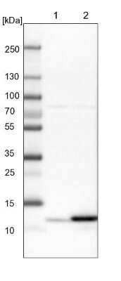 Western Blot: HRSP12 Antibody [NBP1-82452] - Lane 1: Mouse liver tissue lysate Lane 2: Rat liver tissue lysate