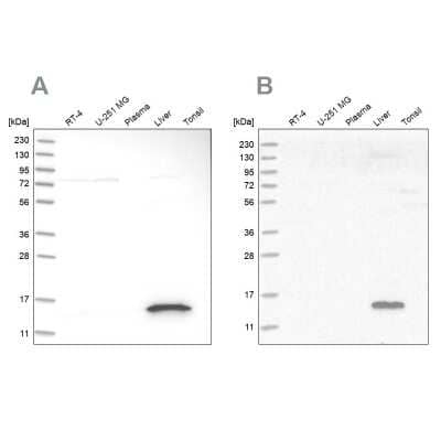 Western Blot: HRSP12 Antibody [NBP1-82452] - Analysis using Anti-RIDA antibody NBP1-82452 (A) shows similar pattern to independent antibody NBP1-82453 (B).