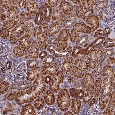 Immunohistochemistry-Paraffin HSD17B8 Antibody