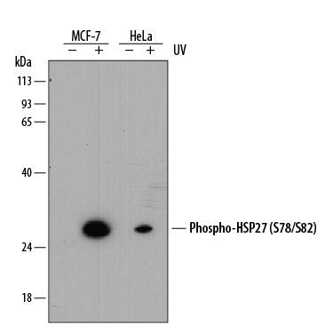 Western blot shows lysates of MCF-7 human breast cancer cell line and HeLa human cervical epithelial carcinoma cell line untreated (-) or treated (+) with 20 mJ/cm2ultraviolet light (UV) with a 30 minute recovery. PVDF membrane was probed with 1 µg/mL of Rabbit Anti-Human Phospho-HSP27 (S78/S82) Monoclonal Antibody (Catalog # MAB23141) followed by HRP-conjugated Anti-Rabbit IgG Secondary Antibody (Catalog # HAF008). A specific band was detected for Phospho-HSP27 (S78/S82) at approximately 27 kDa (as indicated). This experiment was conducted under reducing conditions and using Immunoblot Buffer Group 1.