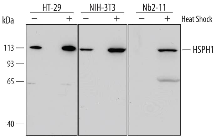 Western blot shows lysates of HT-29 human colon adeno­carcinoma cell line, NIH-3T3 mouse embryonic fibroblast cell line, and Nb2-11 rat lymphoma cell line untreated (-) or treated (+) with heat shock at 42 °C for 30 minutes and allowed to recover at 37 °C for 3 hours. PVDF Membrane was probed with 0.5 µg/mL of Mouse Anti-Human/Mouse/Rat HSPH1 Monoclonal Antibody (Catalog # MAB4029) followed by HRP-conjugated Anti-Mouse IgG Secondary Antibody (Catalog # HAF007). A specific band was detected for HSPH1 at approximately 110 kDa (as indicated). This experiment was conducted under reducing conditions and using Immunoblot Buffer Group 2.