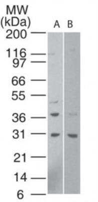 Western Blot: HTRA1/PRSS11 Antibody [NBP2-23869] -  Analysis of HtrA1 in human A) HeLa cell lysate (1 minute exposure) and B) human 293 cell lysate (15 minute exposure) using NBP2-23869 at 1:500.