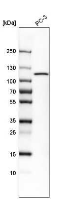 Hexokinase 1 Antibody (NBP1-87480): Novus Biologicals