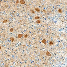 Hexokinase 1/2 was detected in immersion fixed paraffin-embedded sections of human brain medulla tissue using Rabbit Anti-Human Hexokinase 1/2 Antigen Affinity-purified Polyclonal Antibody (Catalog # AF8178) at 1:200 dilution overnight at 4 °C. Tissue was stained using the Anti-Rabbit HRP-DAB Cell & Tissue Staining Kit (brown; Catalog # CTS005) and counterstained with hematoxylin (blue). Specific staining was localized to neurons. View our protocol for Chromogenic IHC Staining of Paraffin-embedded Tissue Sections.
