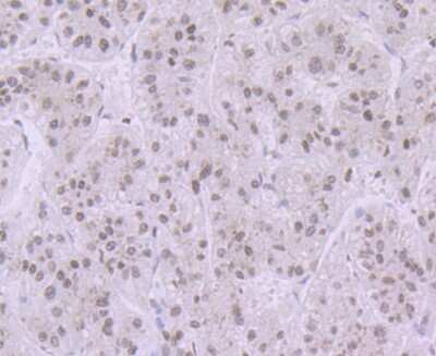 Immunohistochemistry-Paraffin: Histone H3.1 Antibody [NBP2-75524] - Analysis of paraffin-embedded human liver tissue using anti-Histone H3.1 antibody. Counter stained with hematoxylin.