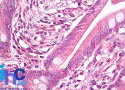 Immunohistochemistry-Paraffin: HSP27 Antibody [NBP2-24533] - FFPE human small intestine probed with HSP27 antibody at 10 ug/mL. Staining of formalin-fixed tissues is enhanced by boiling tissue sections in 10 mM sodium citrate buffer, pH 6.0 for 10-20 min followed by cooling at RT for 20 min.