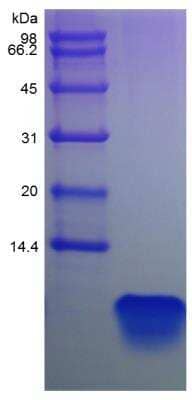 SDS-Page: Human PTH Protein [NBP2-35212]