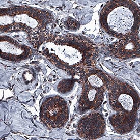 Immunohistochemistry ICAT/CTNNBIP1 Antibody (536017) [Unconjugated]