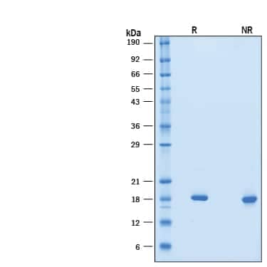 2 μg/lane of Recombinant Mouse IFNAA (Catalog # 10150-IF) was resolved with SDS-PAGE under reducing (R) and non-reducing (NR) conditions and visualized by Coomassie® Blue staining, showing bands at 16-21 kDa.