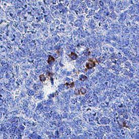     IFN-alpha  4 was detected in immersion fixed paraffin-embedded sections of mouse spleen  using Rat Anti-Mouse IFN-alpha 4 Monoclonal Antibody (Catalog # MAB10259) at  5 µg/mL for 1 hour at room temperature followed by  incubation with the Anti-Rat IgG VisUCyte™ HRP Polymer Antibody  (Catalog # VC005).  Before incubation with the primary antibody, tissue was subjected to  heat-induced epitope retrieval using Antigen Retrieval Reagent-Basic (Catalog  # CTS013).  Tissue was stained using DAB (brown) and counterstained with hematoxylin  (blue). Specific staining was localized to macrophages. View our protocol for  IHC  Staining with VisUCyte HRP Polymer Detection Reagents. 