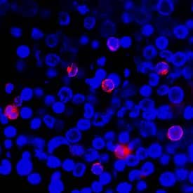 IFN-gamma was detected in immersion fixed human peripheral blood mononuclear cells (PBMCs) stimulated with PHA using Mouse Anti-Human IFN-gamma Monoclonal Antibody (Catalog # MAB285R) at 8 µg/mL for 3 hours at room temperature. Cells were stained using the NorthernLights™ 557-conjugated Anti-Mouse IgG Secondary Antibody (red; Catalog # NL007) and counterstained with DAPI (blue). Specific staining was localized to cytoplasm. View our protocol for Fluorescent ICC Staining of Non-adherent Cells.