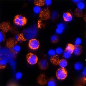 IFN-gamma was detected in immersion fixed feline peripheral blood mononuclear cells (PBMCs) using Mouse Anti-Feline IFN-gamma Monoclonal Antibody (Catalog # MAB764) at 25 µg/mL for 3 hours at room temperature. Cells were stained using the NorthernLights™ 557-conjugated Anti-Mouse IgG Secondary Antibody (red; Catalog # NL007) and counterstained with DAPI (blue). Specific staining was localized to cytoplasm. View our protocol for Fluorescent ICC Staining of Cells on Coverslips.