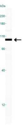 Simple Western: IGF-I R Antibody [NBP1-77679] - Simple Western lane view shows a specific band for IGF-1 R in 0.5 mg/ml of HepG2 lysate.  This experiment was performed under reducing conditions using the 12-230 kDa separation system.