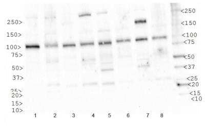 Western Blot: IGF-I R Antibody [NBP1-77679] - Analysis of IGF-1R in 1. HeLa, 2. Ntera2, 3. A431, 4. HepG2, 5. MCF7, 6. NIH/3T3, 7. SK-BR-3 and 8. COS7