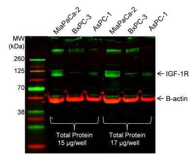 Western Blot: IGF-I R Antibody [NBP1-77680] - Analysis of IGF-I R in human pancreatic cancer cell lines (MiaPaCa-2, AsPC-1, and BxPC-3) using anti-IGF-I R antibody. Image from verified customer review.