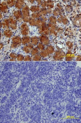 IGFBP-4 was detected in immersion fixed paraffin-embedded sections of human stomach array using Goat Anti-Human IGFBP-4 Biotinylated Antigen Affinity-purified Polyclonal Antibody (Catalog # BAF804) at 10 µg/mL overnight at 4 °C. Tissue was stained using the Anti-Goat HRP-DAB Cell & Tissue Staining Kit (brown; Catalog # CTS008) and counterstained with hematoxylin (blue). Lower panel shows a lack of labeling if primary antibodies are omitted and tissue is stained only with secondary antibody followed by incubation with detection reagents. View our protocol for Chromogenic IHC Staining of Paraffin-embedded Tissue Sections.
