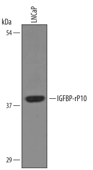 Western Blot IGFBP-rP10/KAZALD1 Antibody [Unconjugated]