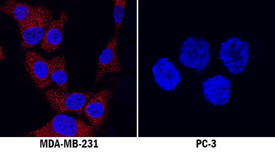 IGF-I/IGF-1 was detected in immersion fixed MDA-MB-123 human breast cancer cell line (left panel, positive stain) and PC-3 human prostate cancer cell line (right panel, negative stain) using Rat Anti-Human IGF-I/IGF-1 Monoclonal Antibody (Catalog # MAB2913) at 8 µg/mL for 3 hours at room temperature. Cells were stained using the NorthernLights™ 557-conjugated Anti-Rat IgG Secondary Antibody (red; Catalog # NL013) and counterstained with DAPI (blue). Specific staining was localized to cytoplasm. View our protocol for Fluorescent ICC Staining of Cells on Coverslips.