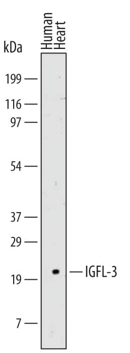 Western blot shows lysates of human heart tissue. PVDF membrane was probed with 2 µg/mL of Mouse Anti-Human IGFL-3 Monoclonal Antibody (Catalog # MAB5970) followed by HRP-conjugated Anti-Mouse IgG Secondary Antibody (Catalog # HAF007). A specific band was detected for IGFL-3 at approximately 15 kDa (as indicated). This experiment was conducted under reducing conditions and using Immunoblot Buffer Group 1.