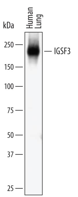 Western blot shows lysates of human lung tissue. PVDF membrane was probed with 2 µg/mL of Mouse Anti-Human IGSF3 Monoclonal Antibody (Catalog # MAB4788) followed by HRP-conjugated Anti-Mouse IgG Secondary Antibody (Catalog # HAF007). A specific band was detected for IGSF3 at approximately 200 kDa (as indicated). This experiment was conducted under non-reducing conditions and using Immunoblot Buffer Group 1.