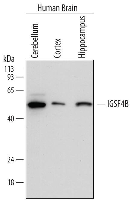 Western blot shows lysates of human brain (cerebellum) tissue, human brain (cortex) tissue, and human brain (hippocampus) tissue. PVDF membrane was probed with 0.2 µg/mL of Mouse Anti-Human IGSF4B/SynCAM3 Monoclonal Antibody (Catalog # MAB3678) followed by HRP-conjugated Anti-Mouse IgG Secondary Antibody (Catalog # HAF007). A specific band was detected for IGSF4B/SynCAM3 at approximately 48 kDa (as indicated). This experiment was conducted under reducing conditions and using Immunoblot Buffer Group 1.